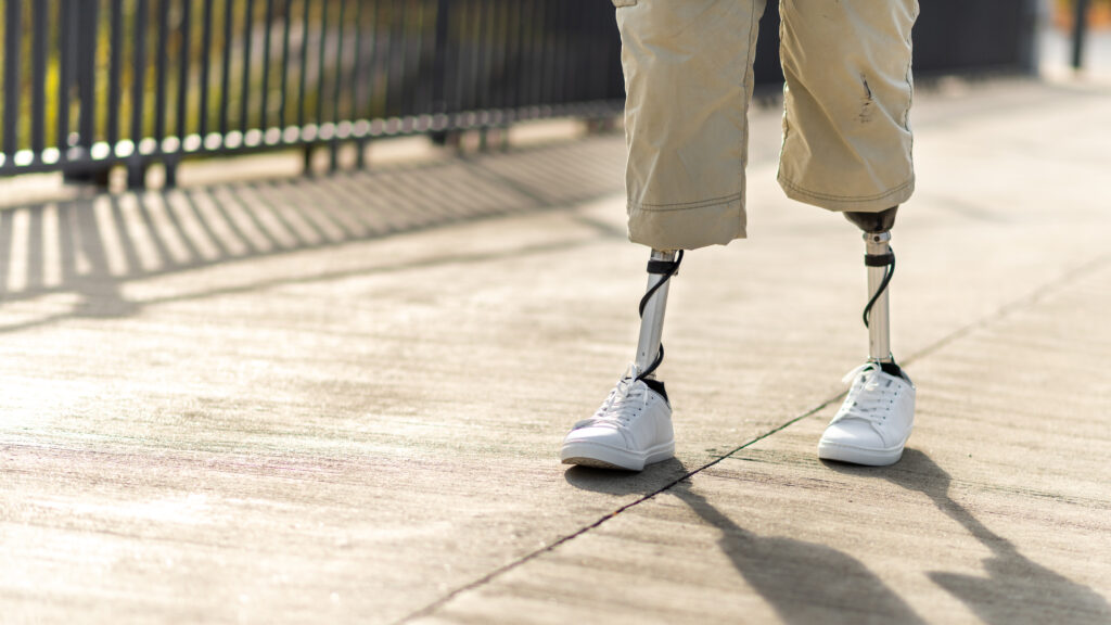 Unlocking Mobility for Paraplegics through Exoskeletons